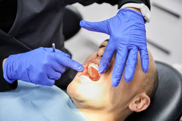 Best Emergency Root Canal Treatment in Houghton Lake, MI