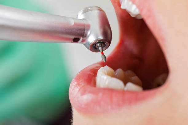 Best Emergency Cosmetic Dentistry in Houghton Lake, MI